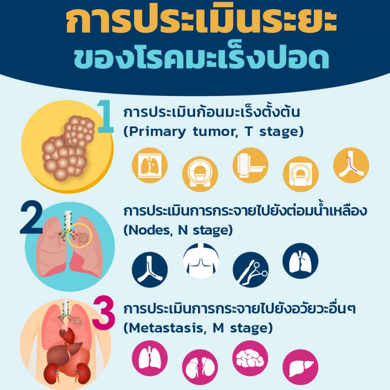 การประเมินระยะของโรคมะเร็งปอด