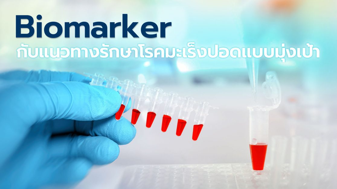 Biomarker