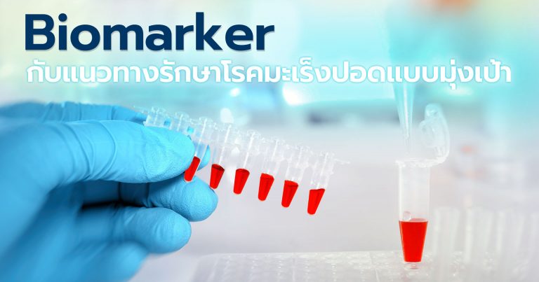 Biomarker กับแนวทางรักษาโรคมะเร็งปอดแบบมุ่งเป้า